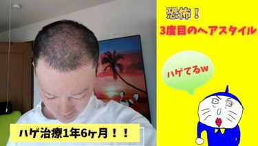 ハゲ日記１年６ヶ月！ヤバイ！！（３度目の脱毛？）ヘアサイクルなのか？ハゲなのか？